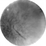 Sun image